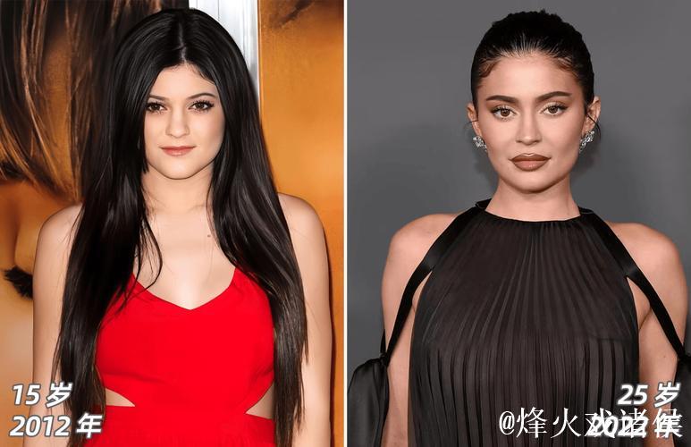 加盟枪手前焦虑困扰凯莉,深受脱发影响 加盟枪手前焦虑困扰凯莉,深受脱发影响